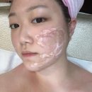 홍대피부관리 곽유정에스테틱 리프팅 후기