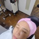 청담힐의원 | PDRN 효과 연어주사 후기 찾고 있다면