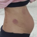 호곡 | 진천미래산부인과 산후조리원 이용 솔직 후기. 금액. 조리원와서 느낀 필수템