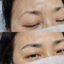 뷰티유스 | 상무지구 눈썹문신 유스뷰티에서 성공 후기!