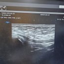 완주테크노솔라 | Challenge Roth 2025 완주기 – 독일의 뜨거운 환호 속으로