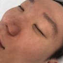 (주)마이티워터 | 충북혁신도시 피부관리 고원장의 모공세척 내돈내산 솔직후기