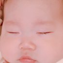 이종흔안과 네이버블로그