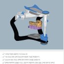 찬스덴탈 이미지