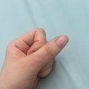 7월 요즘 일상_초파리죽어, 과자펜트리, 청년피자존맛탱, 결막염 경주성모안과, 이디야팥빙수, 운수좋은날