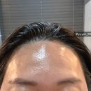 세라헤어라인 이미지