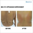 엘리트메디 이미지