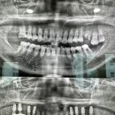 백세튼튼플란트치과의원 이미지
