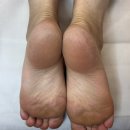 랑뷰티 | 천안 패디플래닝 역시 랑뷰티 왁싱 에스테틱 두정점 I 굳은살없이 맨발로 올여름 당당하게!