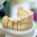 수성더원치과의원 | 환절기 잇몸 건강 비상? 똑똑하게 충치 예방하는 비법 공개해요! feat. 수성구치과