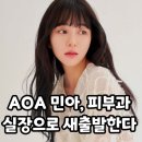 피부과 상담실장된 전 AOA 권민아 이미지