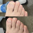미엔느 - 서초구 사임당로 158 | 부산 서면 발톱관리 미엔느뷰티에서 아버지 문제성 발톱 케어 받은 후기