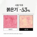 한율초등학교 | 한율 어린쑥 수분진정 패드 3일간사용후기