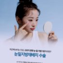 뉴원성형외과의원 네이버블로그