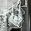 가이치과의원 | 목동 교정치과 7개 상담비교 솔직후기