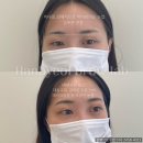 가경동눈썹 육아하는 동안에도 예쁨 잃지 말아요 (+가격정보)