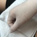휘에스테틱 | 대전여드름압출 잘하는곳 괴정동 리브온에스테틱 후기 : 여드름 유목민 정착지