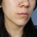 조이필 | 디오디너리 나이아신아마이드 앰플 내돈내산 후기 | 모공 피지 효과 (+아쿠아필·포텐자 시술 후 홈케어)