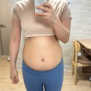 (주)건지 | 대전 팔뚝 지방추출주사, 나만 붓기가 더딘건지..? 7주차 후기