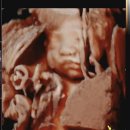 (주)토탈그린 | 고양시 연세 맘스그린 26주 입체초음파 가격 비용 실패 후 성공 후기