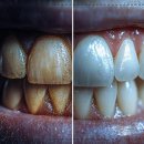 미소를드림치과의원 이미지