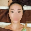 광교 피부관리 허니클 에스테틱 :: 슈가윤곽리프팅관리 후기