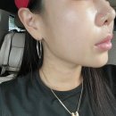 일산역 갤러리 피부과 브이라인을 위한 슈링크300샷 가격 리프팅 후기