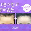헤어짱헤어라인
