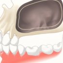 서울정플란트치과의원 이미지