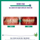 내이치과기공소 이미지