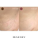 레브케어 이미지