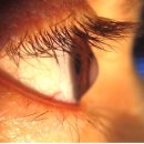 밝은눈안경원 이미지