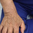 강산의료기 이미지