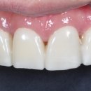 엘리트치과기공소 이미지