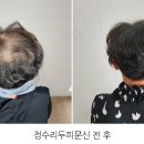 헤드라인유 이미지