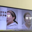 귀일지 | 공덕 피부과 요정귀필러 맞은 후기