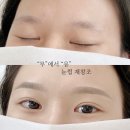 보니떼뷰티 | 평택 눈썹 문신, 왜 사람마다 유지 기간이 다를까요?