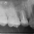 디지레이 이미지