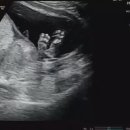 리안산부인과의원 이미지