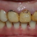 에이블덴탈 이미지