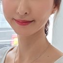 멍이랑 양이랑 | 부평역 피부과 입술필러 일주일간 멍 붓기 사진후기