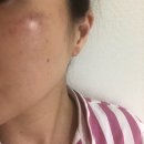 태극약국 | 태극제약 도미나크림 기미 원인 아침 사용법 후기