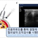 대한갑상선영상의학회