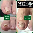 닥터아이티엔발톱깎이 이미지