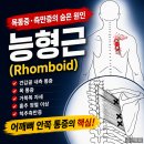 목통증·견갑골 안쪽 통증의 숨은 원인 능형근(Rhomboid)의 해부학과 임상적 의미 이미지