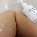 삼일모타 | 다형홍반 증상 원인과 3개월걸린 극복후기