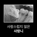 시흥 은계지구치과 사랑니 발치는 소문처럼 무서울까?