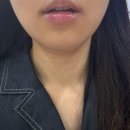 [일직동 피부관리] 💆🏻‍♀️ 골드미스 3D리덕션테라피 후기_일직동 피부샵 / 광명역 에스테틱 🧴