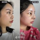 제이티성형외과의원 이미지