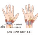 손이 저리고 손가락이 딸깍 거린다면저자 : 신영호 이미지